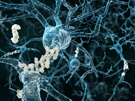 Alzheimer’s & CRISPR: How Gene Editing is Revolutionizing Disease Research